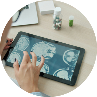 Medical staff reviewing brain data